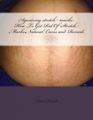 Carte Agonizing stretch marks-How To Get Rid Of Stretch Marks: Natural Cures and Remedi Lisa Drake