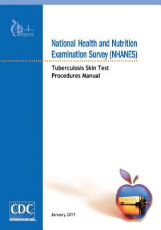 Kniha National Health and Nutrition Examination Survey (NHANES): Tuberculosis Skin Test Procedures Manual Centers for Disease Cont And Prevention