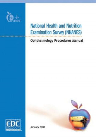 Kniha National Health and Nutrition Examination Survey (NHANES): Ophthalmology Procedures Manual Centers for Disease Cont And Prevention