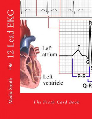 Book 12 Lead EKG: The Flash Card Book Medic Smith