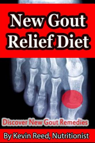 Carte New Gout Relief Diet: Discover New Gout Remedies? Kevin Reed