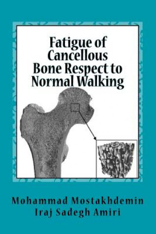 Book Fatigue of Cancellous Bone Respect to Normal Walking Mohammad Mostakhdemin