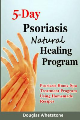 Kniha 5-Day Psoriasis Natural Healing Program: Psoriasis Home-Spa Treatment Program Using Homemade Recipes Douglas Whetstone