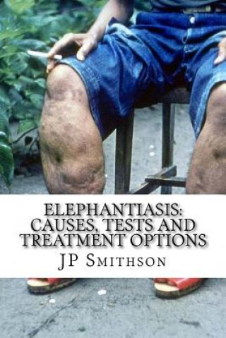 Kniha Elephantiasis: Causes, Tests and Treatment Options Jp Smithson Ma