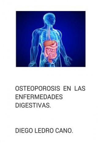 Kniha Osteoporosis en las enfermedades digestivas. Dr Diego Ledro-Cano