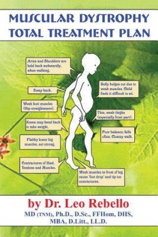 Knjiga Muscular Dystrophy: Total Treatment Plan Dr Leo Rebello