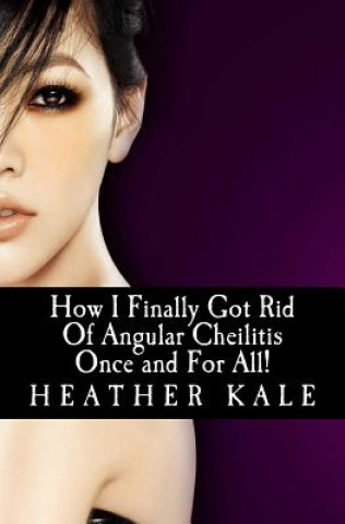 Buch How I Finally Got Rid Of Angular Cheilitis Once and For All!: Cracked Mouth Corners No More Heather Kale