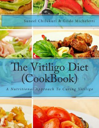 Könyv The Vitiligo Diet (CookBook): A Nutritional Approach To Curing Vitiligo Suneel Chilukuri