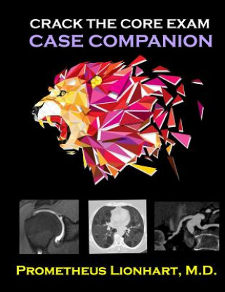 Kniha Crack the CORE Exam - Case Companion Prometheus Lionhart M D