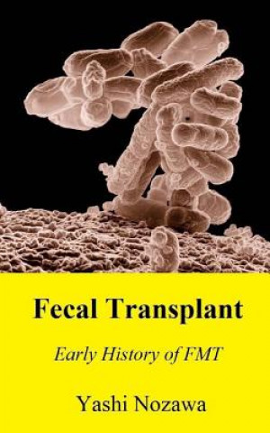Kniha Fecal Transplant: Early History of FMT Yashi Nozawa