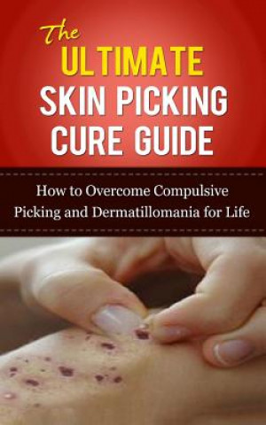 Könyv The Ultimate Skin Picking Cure Guide: How to Overcome Compulsive Picking and Dermatillomania for Life Caesar Lincoln