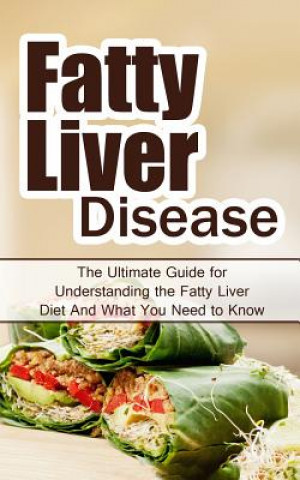 Kniha Fatty Liver Disease: The Ultimate Guide for Understanding the Fatty Liver Diet And What You Need to Know Wade Migan