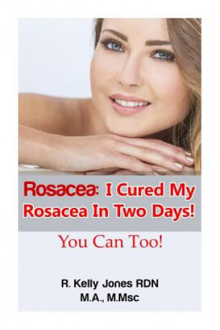 Könyv Rosacea: I Cured My Rosacea In Two Days! You Can Too! R Kelly Jones