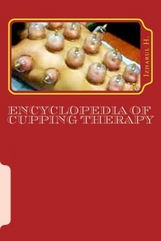 Knjiga Encyclopedia of Cupping Therapy: Al-Hijama Izharul H