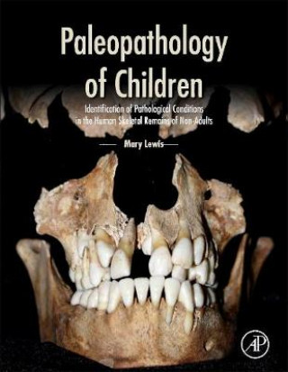 Książka Paleopathology of Children Mary Lewis