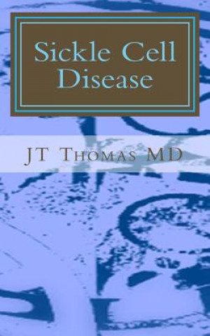 Boek Sickle Cell Disease: Fast Focus Study Guide Jt Thomas MD