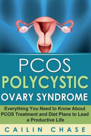 Carte PCOS Polycystic Ovary Syndrome: Everything You Need to Know About PCOS Treatment and Diet Plans to Lead a Productive Life Cailin Chase
