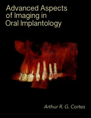 Kniha Advanced Aspects of Imaging in Oral Implantology Arthur Rodriguez Gonzalez Cortes