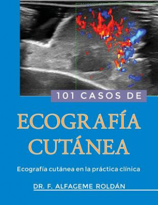 Buch 101 Casos de Ecografia Cutanea: Ecografía cutánea en la práctica clínica Dr Fernando Alfageme Roldan