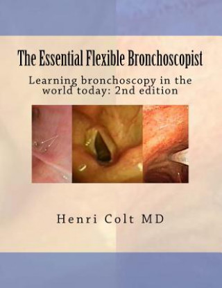 Kniha Essential Flexible Bronchoscopist Henri Colt