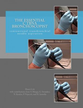 Kniha The Essential cTBNA Bronchoscopist: conventional TransBronchial Needle Aspiration Henri Colt