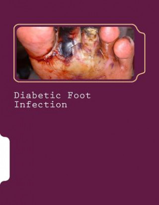 Libro Diabetic Foot Infection Dr Romana Ayub