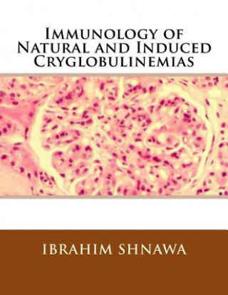 Book Immunology of Natural and Induced Cryoglobulinemia Ibrahim M-S Shnawa