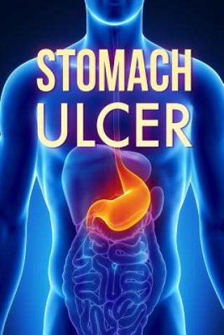 Kniha Stomach Ulcer: Treatment in 60 days!: Stomach Ulcer treatment David L Jonathan