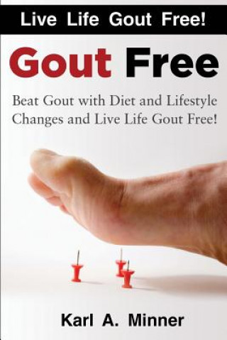 Livre Gout Free: Beat Gout with Diet and Lifestyle Changes and Live Life Gout Free! MR Karl a Minner