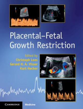 Carte Placental-Fetal Growth Restriction Gerard H. A. (University of Cambridge) Visser