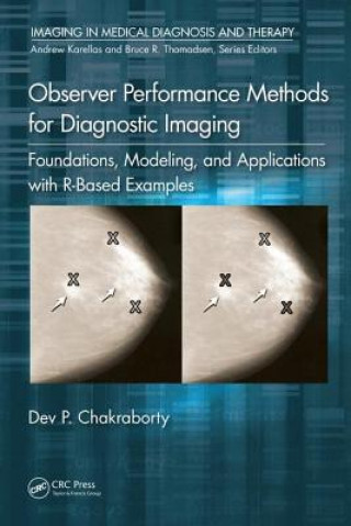 Knjiga Observer Performance Methods for Diagnostic Imaging CHAKRABORTY