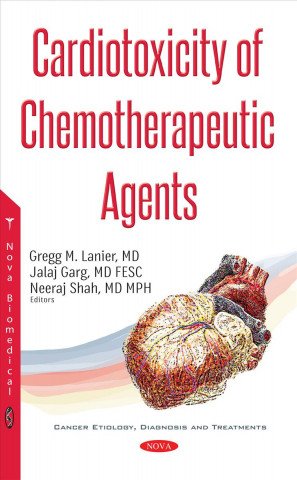 Könyv Cardiotoxicity of Chemotherapeutic Agents 