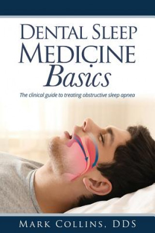 Kniha Dental Sleep Medicine Basics DDS MARK COLLINS