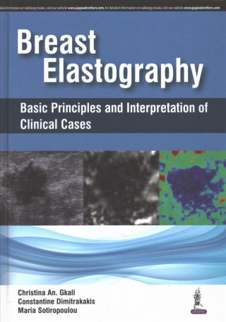 Knjiga Breast Elastography Christina An Gkali