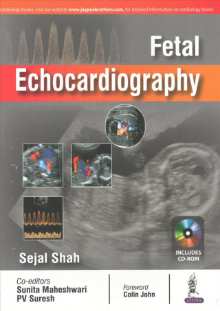Kniha Fetal Echocardiography Sejal Shah