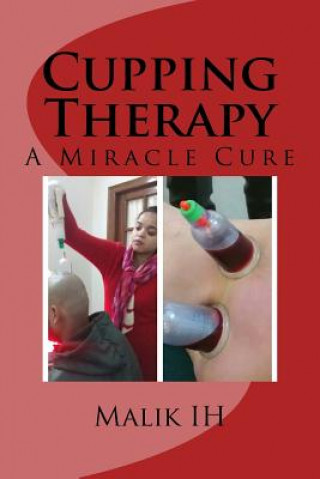 Kniha Cupping Therapy: A Miracle Cure Malik Ih