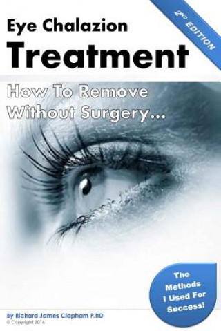 Könyv Eye Chalazion: How To Remove Without Surgery: My personal experience and the methods I used for success MR Richard James Clapham Phd