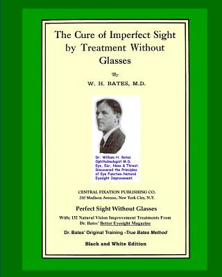 Kniha Cure Of Imperfect Sight by Treatment Without Glasses William H. Bates