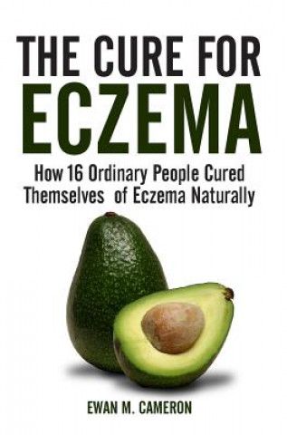 Книга Cure for Eczema Ewan M. Cameron