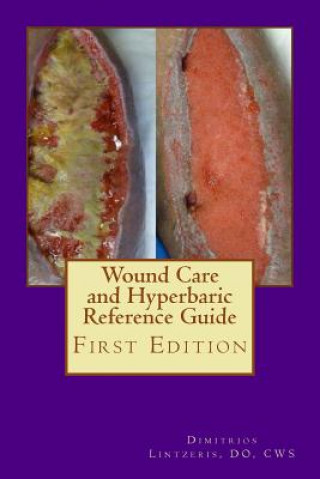 Book Wound Care and Hyperbaric Reference Guide Dimitrios P Lintzeris Do
