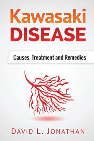 Könyv Kawasaki disease - A Slowly Developed Health Issue: Causes, Treatment and Remedies David L Jonathan