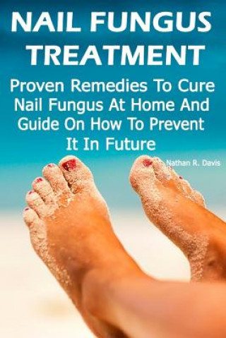 Kniha Nail Fungus Treatment: Proven Remedies To Cure Nail Fungus At Home And Guide On How To Prevent It In Future: (How to Cure Toenail Fungus) Nathan R Davis