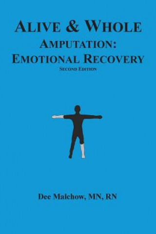 Carte Alive & Whole Amputation: Emotional Recovery Rn Dee Malchow Mn