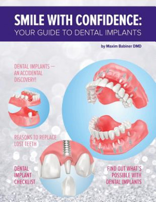 Kniha Smile with confidence: Your guide to dental implants Maxim Babiner DMD