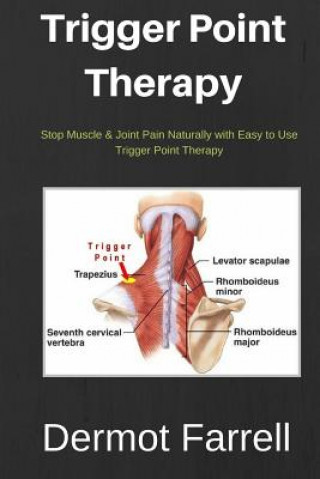 Книга Trigger Point Therapy: Stop Muscle & Joint Pain Naturally with Easy to use Trigger Point Therapy MR Dermot Farrell