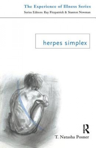 Könyv Herpes Simplex T.Natasha Posner