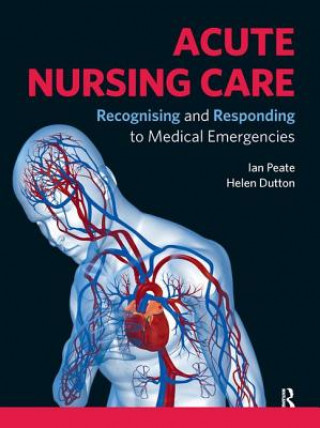 Kniha Acute Nursing Care Ian Peate