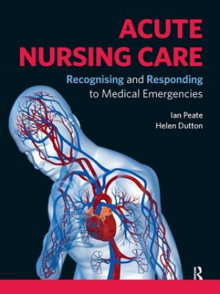 Knjiga Acute Nursing Care Ian Peate