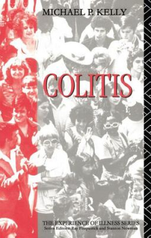 Knjiga Colitis Michael P. Kelly
