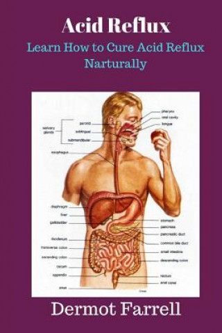 Knjiga Acid Reflux: Learn How to Cure Acid Reflux Naturally MR Dermot Farrell